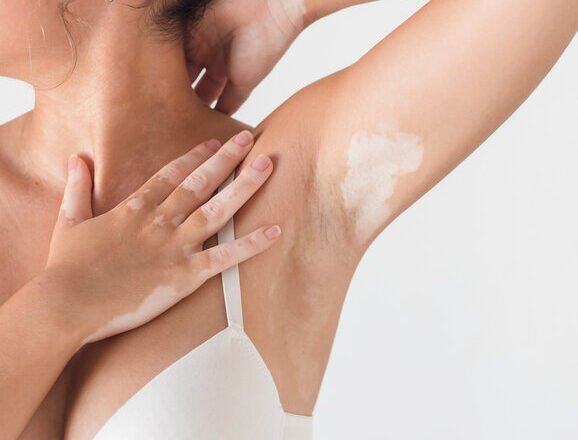 I’m Turning 30 And It’s Time For Me To Learn About My Breast Health!